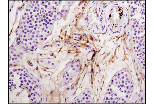 Immunohistochemical analysis of paraffin-embedded human testes using Integrin β3 (D7X3P) XP ® Rabbit mAb.