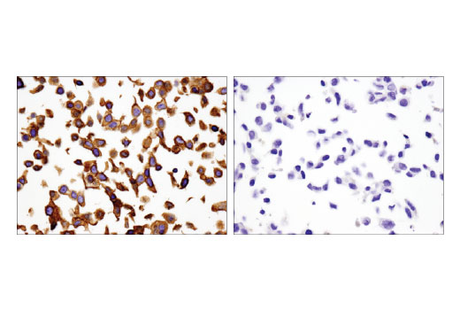 Immunohistochemical analysis of paraffin-embedded HT-29 (left) and LNCaP (right) cell pellets using Integrin β4 (D8P6C) XP ® Rabbit mAb.
