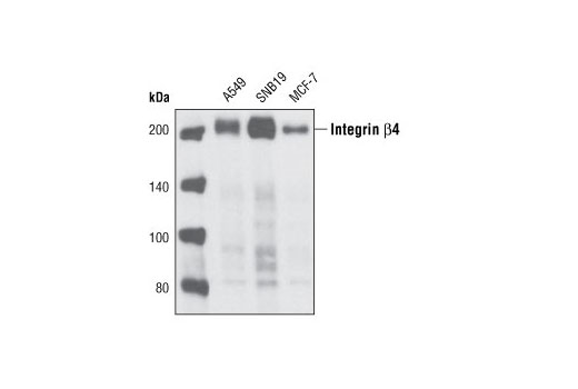 Western blot analysis of extracts from various cell types using Integrin β4 Antibody.