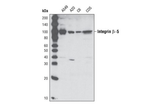 Western blot analysis of extracts from various cell lines using Integrin β5 (D24A5) Rabbit mAb.