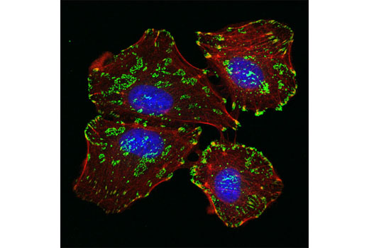 Confocal immunofluorescent analysis of A549 cells using Integrin β5 (D24A5) Rabbit mAb (green). Actin filaments were labeled using DY-554 phalloidin (red). Blue pseudocolor = DRAQ5® #4084 (fluorescent DNA dye).