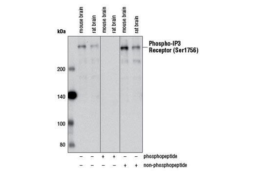 Western blot analysis of extracts from mouse and rat brain using Phospho-IP3 Receptor (Ser1756) (D10E3) Rabbit mAb. The phospho-specificity of the antibody was verified by preincubating the antibody with no peptide, with IP3 receptor (Ser1756) phosphopeptide, or with IP3 receptor (Ser1756) non-phosphopeptide prior to incubating the membrane.