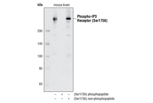 Western blot analysis of extracts from mouse brain using Phospho-IP3 Receptor (Ser1756) Antibody. The phospho-specificity of the antibody was verified by preincubating the antibody with no peptide, with IP3 Receptor (Ser1756) phosphopeptide or with IP3 Receptor (Ser1756) non-phosphopeptide prior to incubating the membrane.