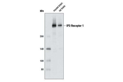 Western blot analysis of extracts from mouse and rat brain using IP3 Receptor 1 (D53A5) Rabbit mAb.