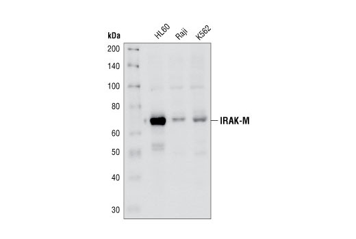 Western blot analysis of extracts from HL-60, Raji and K562 cell lines, using IRAK-M Antibody.