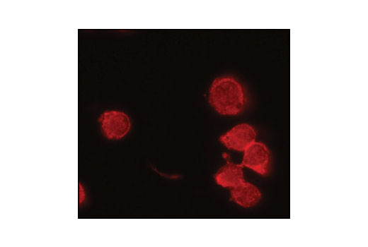 Immunofluorescent analysis of THP-1 cells differentiated overnight with TPA, using IRAK-M Antibody.