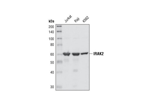 Western blot analysis of extracts from Jurkat, Raji and K562 cell lines, using IRAK2 Antibody #4367.
