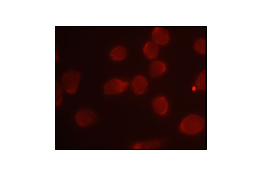 Immunofluorescent staining of HeLa cells, using IRAK2 Antibody.