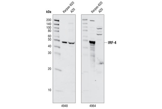 Western blot analysis of extracts from KARPAS-620 (human) and A20 (mouse) cells using IRF-4 Antibody #4964 and IRF-4 (P173) Antibody #4948.