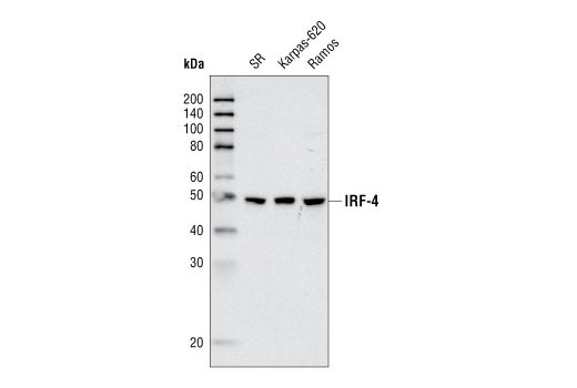 Western blot analysis of extracts from SR, KARPAS-620 and Ramos cells using IRF-4 (P173) Antibody.
