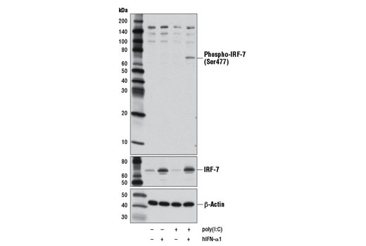 Western blot analysis of extracts from HT-29 cells, untreated or treated with Human Interferon-α1 (hIFN-α1) #8927 (10 ng/ml, overnight) followed by transfection with poly(I:C) (2.5 μg/ml, 7 hr), as indicated, using Phospho-IRF-7 (Ser477) (D7E1W) Rabbit mAb (upper), IRF-7 Antibody #4920 (middle), or β-Actin (D6A8) Rabbit mAb #8457 (lower).