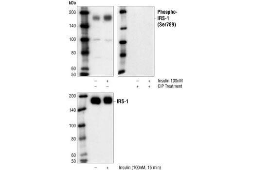 Western blot analysis of extracts from 293 cells overexpressing IRS-1, untreated or treated with insulin for 15 minutes, using Phospho-IRS-1 (Ser789) Antibody (upper) or IRS-1 Antibody #2382 (lower). The CIP treatment abolished the immunoreactivity of Phospho-IRS-1 (Ser789) Antibody with IRS-1 (upper, right).