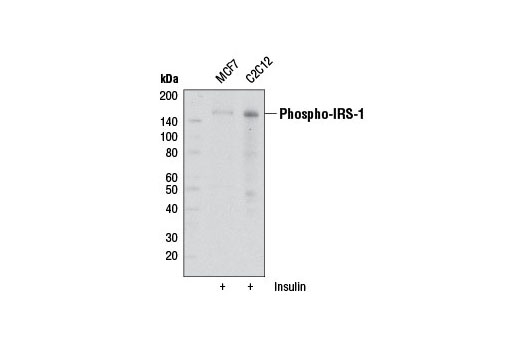 Western blot analysis of insulin treated (100 nM, 5 min) MCF7 and C2C12 cells using Phospho-IRS-1 (Ser302) (34C7) Rabbit mAb.