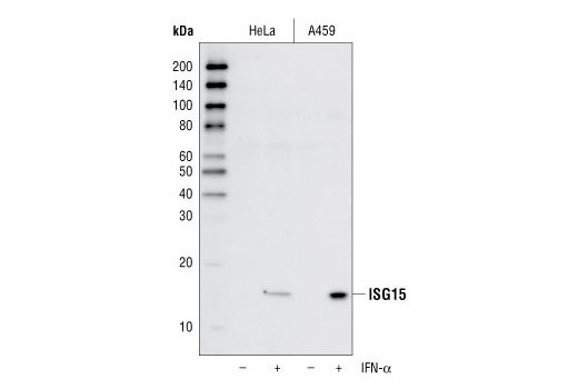 Western blot analysis of lysates from HeLa and A549 cells, untreated (-) or treated with IFN-α (1000 U/mL) (+) for 24 hours, using ISG15 (22D2) Rabbit mAb.