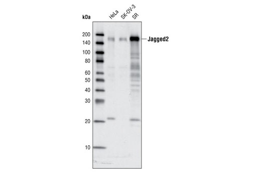 Western blot analysis of total cell lysates from HeLa, SK-OV-3 and SR cells using Jagged2 (C83A8) Rabbit mAb.