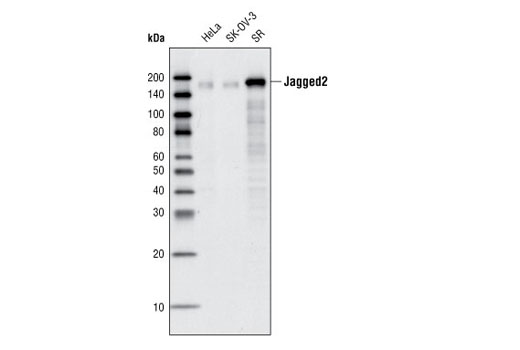 Western blot analysis of total cell lysates from HeLa, SK-OV-3 and SR cells using Jagged2 (C23D2) Rabbit mAb.