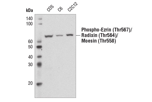  Western blot analysis of extracts from COS, C6, and C2C12 cells using Phospho-Ezrin (Thr567)/Radixin (Thr564)/Moesin (Thr558) (41A3) Rabbit mAb (Biotinylated).