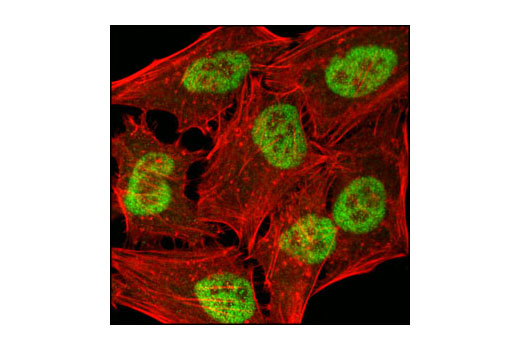 Confocal immunofluorescent analysis of HeLa cells using JMJD1B (C69G2) Rabbit mAb (green). Actin filaments have been labeled with DY-554 phalloidin (red).