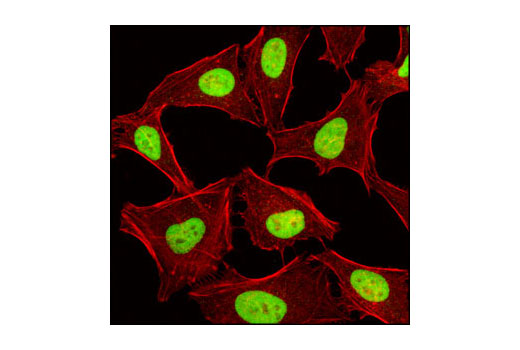 Confocal immunofluorescent analysis of HeLa cells using JMJD1B/JHDM2B Antibody (green). Actin filaments have been labeled with Alexa Fluor ® 555 phalloidin (red).