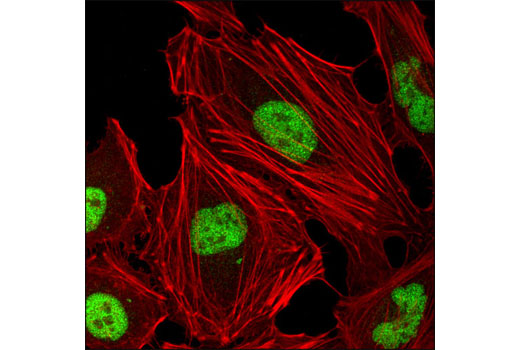 Confocal immunofluorescent analysis of HeLa cells using JMJD1B (6A1-1F5) Mouse mAb (green). Actin filaments were labeled using DY-554 phalloidin (red).
