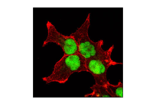 Confocal immunofluorescent analysis of NCCIT cells using JMJD2A (C70G6) Rabbit mAb (green). Actin filaments have been labeled with DY-554 phalloidin (red).