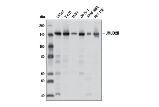 Western blot analysis of extracts from various cell lines using JMJD2B (D7E6) Rabbit mAb.