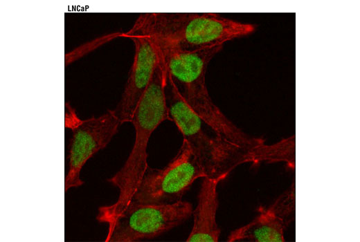 Confocal immunofluorescent analysis of LNCaP cells using JMJD2B (D7E6) Rabbit mAb (green). Actin filaments were labeled with DY-554 phalloidin (red).