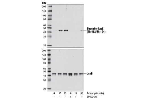Western blot analysis of extracts from 293T cells treated with Anisomycin (25 ug/ml) for the time indicated, with or without pretreatment with JNK inhibitor SP600125 (40 min, 50 uM), using Phospho-JunB (Thr102/Thr104) (D3C6) Rabbit mAb (upper) or JunB (C37F9) Rabbit mAb #3753 (lower).