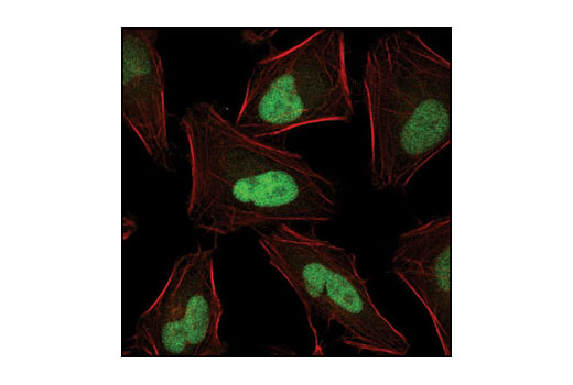 Confocal immunofluorescent analysis of HeLa cells using JunB (P169) Antibody (green). Actin filaments have been labeled with Alexa Fluor ® 555 phalloidin (red).