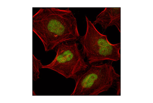 Confocal immunofluorescent analysis of HeLa cells using JunB (G53) Antibody (green). Actin filaments have been labeled with Alexa Fluor ® 555 phalloidin (red).