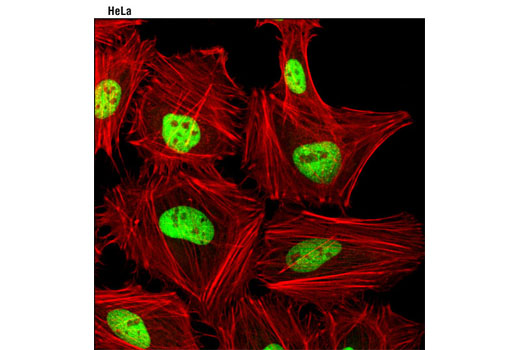 Confocal immunofluorescent analysis of HeLa cells using JunD (D17G2) Rabbit mAb (green). Actin filaments were labeled with DY-554 phalloidin (red).
