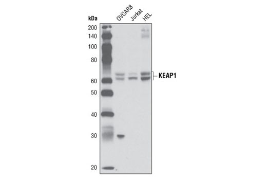 Western blot analysis of extracts from OVCAR-8, Jurkat and HEL cells using KEAP1 (P586) Antibody.