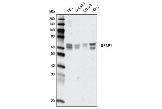 Western blot analysis of extracts from various cell lines using KEAP1 (H436) Antibody.