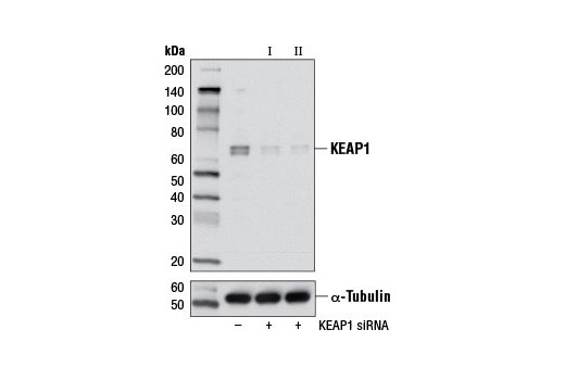 Western blot analysis of extracts from OVCAR8 cells, transfected with 100 nM SignalSilence ® Control siRNA (Unconjugated) #6568 (-), SignalSilence ® KEAP1 siRNA I #5285 (+) or SignalSilence ® KEAP1 siRNA II #5289 (+), using KEAP1 (D1G10) Rabbit mAb (upper) or α-Tubulin (11H10) Rabbit mAb #2125 (lower). The KEAP1 (D1G10) Rabbit mAb confirms silencing of KEAP1 expression, while the α-Tubulin (11H10) Rabbit mAb is used as a loading control.