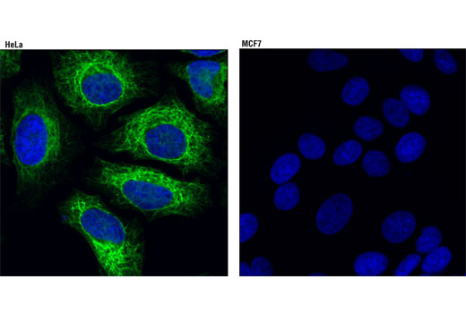 Confocal immunofluorescent analysis of HeLa (left) and MCF7 (right) cells using Keratin 7 (D1E4) XP ® Rabbit mAb (green). Blue pseudocolor = DRAQ5 ® #4084 (fluorescent DNA dye).