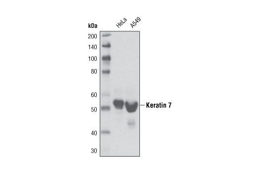 Western blot analysis of extracts from HeLa and A549 cells using Keratin 7 (R458) Antibody.