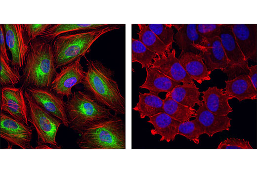 Confocal immunofluorescent analysis of HeLa (left) and MCF7 (right) cells using Keratin 7 (R458) Antibody (green). Actin filaments have been labeled with DY-554 phalloidin (red). Blue pseudocolor = DRAQ5 ® #4084 (fluorescent DNA dye).