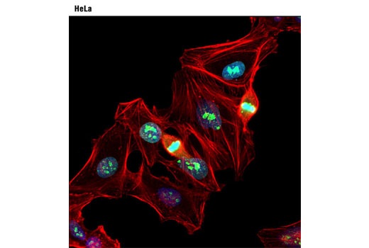 Confocal immunofluorescent analysis of HeLa cells using Ki-67 (D3B5) Rabbit mAb (green). Actin filaments were labeled with DY-554 phalloidin (red). Blue pseudocolor = DRAQ5 ® #4084 (fluorescent DNA dye).