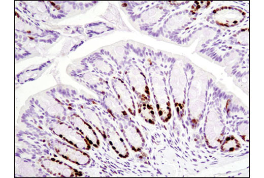 Immunohistochemical analysis of paraffin-embedded mouse colon using Ki-67 (D3B5) Rabbit mAb (Mouse Preferred; IHC Formulated).