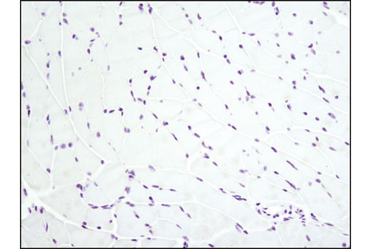 Immunohistochemical analysis of paraffin-embedded mouse heart using Ki-67 (D3B5) Rabbit mAb (Mouse Preferred; IHC Formulated). Heart is negative, as expected.