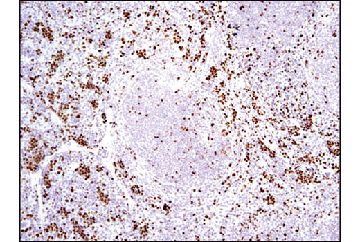 Immunohistochemical analysis of paraffin-embedded mouse spleen using Ki-67 (D3B5) Rabbit mAb (Mouse Preferred; IHC Formulated).