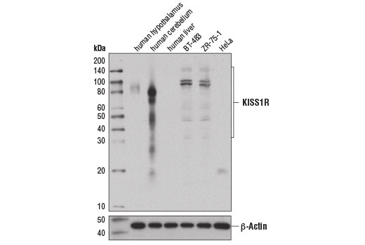 Western blot analysis of extracts from various tissues and cell lines using KISS1R (D9D7C) Rabbit mAb (upper) and β-Actin (D6A8) Rabbit mAb #8457 (lower).