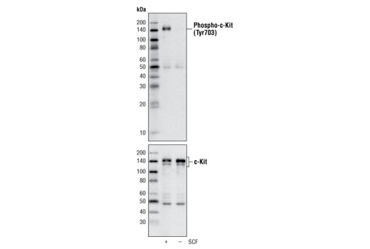 Western blot analysis of extracts of H526 cells, untreated or treated with SCF, using Phospho-c-Kit (Tyr703) (D12E12) Rabbit mAb (upper) or c-Kit Antibody #3392 (lower).