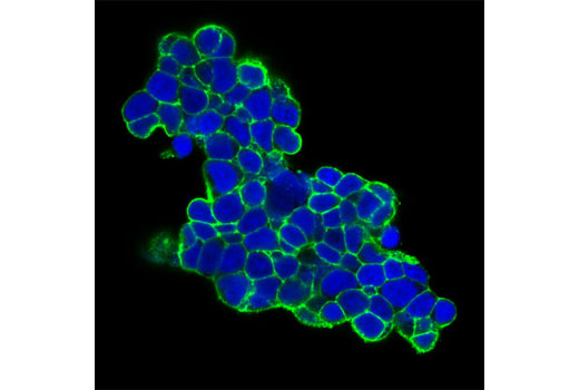 Confocal immunofluorescent analysis of NCI-H526 cells using c-Kit (Ab81) Mouse mAb (green). Blue pseudocolor = DRAQ5 ® #4084 (fluorescent DNA dye).
