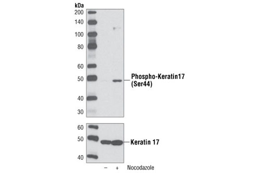 Western blot analysis of extracts of HeLa cells, either untreated or treated with nocodazole, using Phospho-Keratin 17 (Ser44) Antibody (upper) or Keratin 17 #3984 (lower).