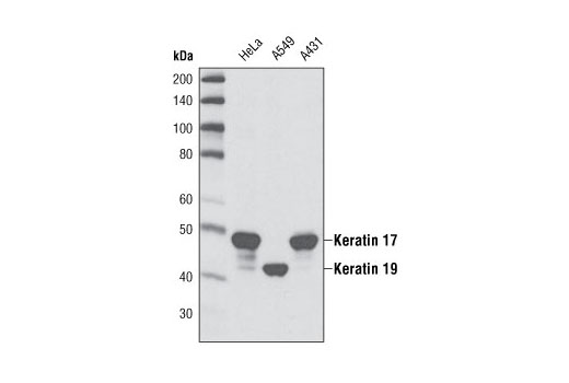 Western blot analysis of extracts of HeLa, A549 and A431 cells using Keratin 17/19 (D32D9) XP ® Rabbit mAb. As expected, keratin 17 is detected in HeLa and A431 cells while keratin 19 is found in A549 cells.