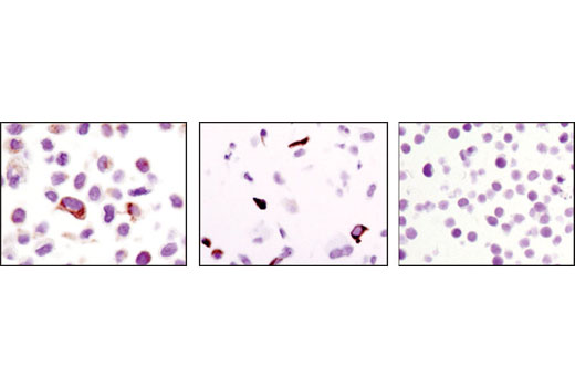 Immunohistochemical analysis of paraffin-embedded HeLa cells (keratin 17 positive) (left), A549 cells (keratin 19 positive) (middle), and Jurkat cells (keratin 17/19 negative) (right) using Keratin 17/19 (D32D9) XP ® Rabbit mAb.