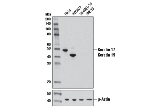 Western blot analysis of extracts from various cell lines using Keratin 17/19 (D4G2) XP ® Rabbit mAb (upper) or β-Actin (D6A8) Rabbit mAb #8457 (lower).