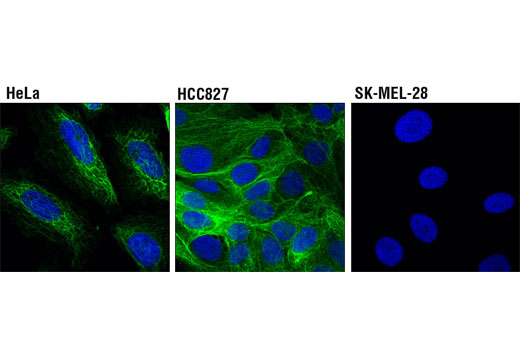 Confocal immunofluorescent analysis of keratin 17 positive HeLa (left), keratin 19 positive HCC827 (middle), and keratin 17/19 negative SK-MEL-28 (right) cells, using Keratin 17/19 (D4G2) XP ® Rabbit mAb (green). Blue pseudocolor= DRAQ5 ® #4084 (fluorescent DNA dye).