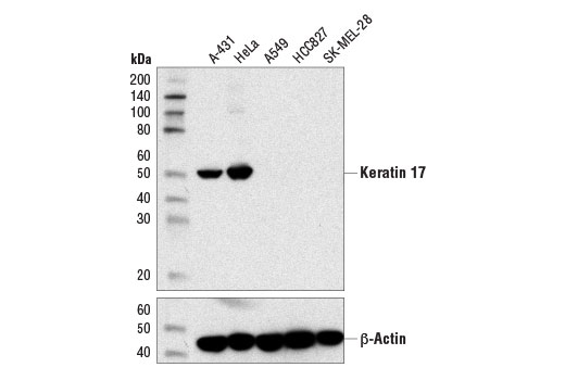 Western blot analysis of extracts from various cell lines using Keratin 17 (D12E5) XP ® Rabbit mAb (upper) and β-Actin (D6A8) Rabbit mAb #8457 (lower).